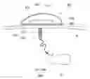 Fig. 01 - Surgical retractor assembly