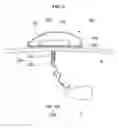 Fig. 04 - Surgical retractor assembly