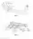 Fig. 11 - Apparatus for generating motion around a remote centre of motion