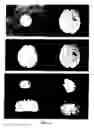 Fig. 08 - Systems and methods for navigation and simulation of minimally invasive therapy