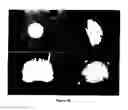 Fig. 09 - Systems and methods for navigation and simulation of minimally invasive therapy