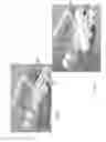 Fig. 10 - Parallel alignment apparatus for facilitating prosthodontic restorations and method of use