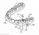 Fig. 01 - COMPUTER AUTOMATED DEVELOPMENT OF AN ORTHODONTIC TREATMENT PLAN AND APPLIANCE