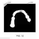 Fig. 20 - COMPUTER AUTOMATED DEVELOPMENT OF AN ORTHODONTIC TREATMENT PLAN AND APPLIANCE