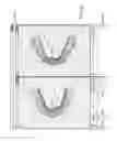 Fig. 28 - COMPUTER AUTOMATED DEVELOPMENT OF AN ORTHODONTIC TREATMENT PLAN AND APPLIANCE