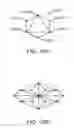 Fig. 29 - COMPUTER AUTOMATED DEVELOPMENT OF AN ORTHODONTIC TREATMENT PLAN AND APPLIANCE