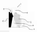 Fig. 01 - Method and tools for indirect bracket positioning