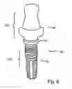Fig. 08 - ANCHORING ELEMENT AND METHOD FOR PRODUCING SAME