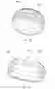 Fig. 03 - Dental attachment assembly cap and method of use