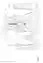 Fig. 02 - Dental Tool for Customizing Implants, System and Methods Thereof