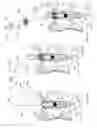 Fig. 04 - Dental Tool for Customizing Implants, System and Methods Thereof