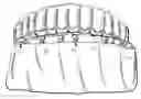 Fig. 01 - COMPONENTS FOR  PERMANENT REMOVABLE AND ADJUSTABLE DENTURES AND BRIDGES