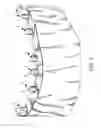 Fig. 02 - COMPONENTS FOR  PERMANENT REMOVABLE AND ADJUSTABLE DENTURES AND BRIDGES