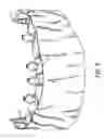 Fig. 04 - COMPONENTS FOR  PERMANENT REMOVABLE AND ADJUSTABLE DENTURES AND BRIDGES