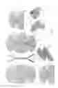 Fig. 02 - Surgical implant