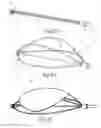 Fig. 05 - Device and method for deploying and attaching an implant to a biological tissue