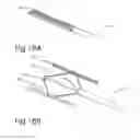 Fig. 40 - Device and method for deploying and attaching an implant to a biological tissue