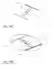 Fig. 41 - Device and method for deploying and attaching an implant to a biological tissue