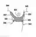 Fig. 01 - Systems and methods for mastopexy
