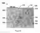 Fig. 06 - TREATMENT METHOD FOR INHIBITING PLATELET ATTACHMENT AND ARTICLES TREATED THEREBY