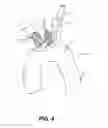 Fig. 09 - Aortic great vessel protection