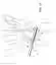 Fig. 14 - SCAPHOLUNATE CONSTRUCT
