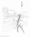 Fig. 19 - SCAPHOLUNATE CONSTRUCT