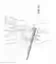 Fig. 22 - SCAPHOLUNATE CONSTRUCT