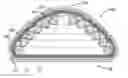 Fig. 01 - Human implantable tissue expanders