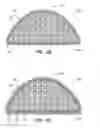 Fig. 03 - Human implantable tissue expanders