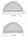Fig. 10 - Human implantable tissue expanders