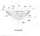 Fig. 04 - Bioanalogic intraocular lens