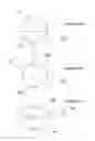 Fig. 07 - Bioanalogic intraocular lens