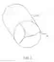 Fig. 02 - PERCUTANEOUSLY IMPLANTABLE REPLACEMENT HEART VALVE DEVICE AND METHOD OF MAKING SAME