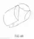 Fig. 05 - PERCUTANEOUSLY IMPLANTABLE REPLACEMENT HEART VALVE DEVICE AND METHOD OF MAKING SAME