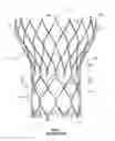 Fig. 02 - Stent cell bridge for cuff attachment