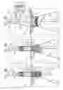 Fig. 15 - VENTRICULARLY-ANCHORED PROSTHETIC VALVES