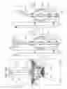 Fig. 18 - VENTRICULARLY-ANCHORED PROSTHETIC VALVES