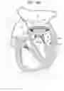 Fig. 19 - VENTRICULARLY-ANCHORED PROSTHETIC VALVES