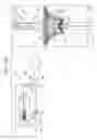 Fig. 24 - VENTRICULARLY-ANCHORED PROSTHETIC VALVES