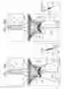 Fig. 27 - VENTRICULARLY-ANCHORED PROSTHETIC VALVES