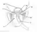 Fig. 01 - System for cardiac valve repair