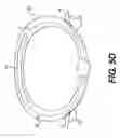 Fig. 06 - Devices for remodeling a valve annulus and ventricle
