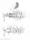 Fig. 02 - Soft tissue anchors and implantation techniques