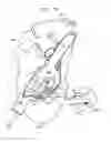 Fig. 12 - Soft tissue anchors and implantation techniques