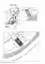 Fig. 15 - Soft tissue anchors and implantation techniques