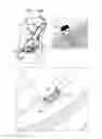 Fig. 18 - Soft tissue anchors and implantation techniques