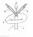 Fig. 01 - A Medical Device And Method For Facilitating Selection Of An Annuloplasty Implant