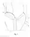 Fig. 02 - A Medical Device And Method For Facilitating Selection Of An Annuloplasty Implant
