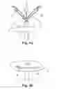 Fig. 05 - A Medical Device And Method For Facilitating Selection Of An Annuloplasty Implant